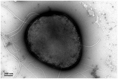 Genome Sequencing of Sulfolobus sp. A20 from Costa Rica and Comparative Analyses of the Putative Pathways of Carbon, Nitrogen, and Sulfur Metabolism in Various Sulfolobus Strains